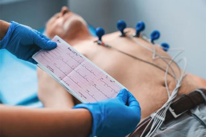 Sant Saúde - Electrocardiograma